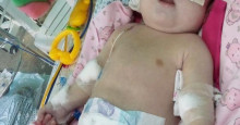 Bebê com doença grave aguarda transferência para realizar cirurgia; demora angustia a mãe