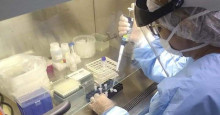 Lacen-PI implanta novo método que detecta tuberculose em pessoas sem sintomas