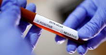 Brasil fará teste em massa para saber número de infectados por coronavírus