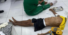 Paciente morre após ser atendido no chão por falta de leito na Upa do Promorar