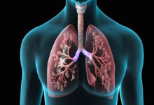 Covid-19 pode causar sequelas graves em pessoas com tuberculose
