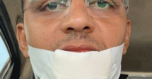 Vereador Ismael Silva sofre acidente com facão e corta o rosto na praça do Mafuá